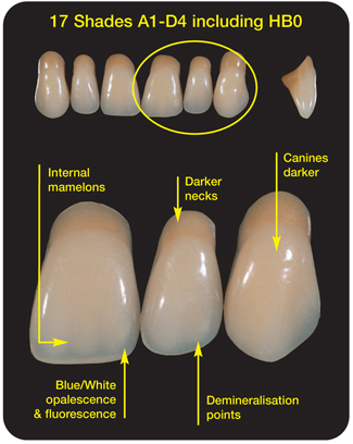 Cosmetic Dentures